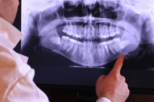 Best Knocked-Out Tooth Emergency  in North Barrington, IL